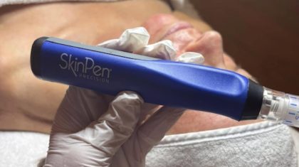 Foto | Skinpen door Huidinstituut Purifé